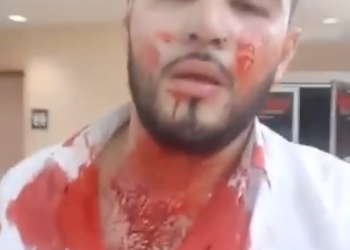 Ex concursante de “La Voz México” transmite video tras ser baleado