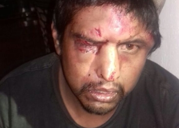Termina parranda robado y golpeado