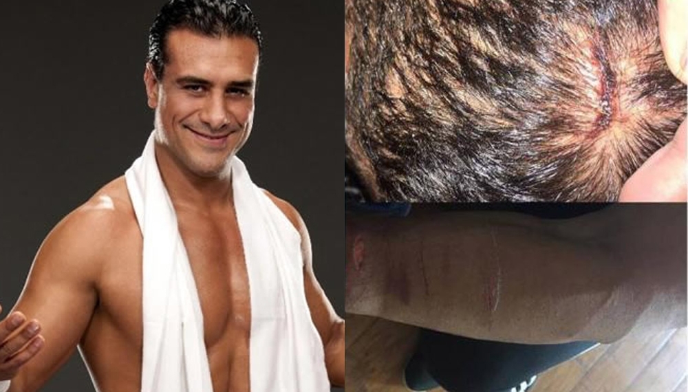 Hieren a navajazos al luchador Alberto del Río, “El Patrón”
