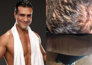 Hieren a navajazos al luchador Alberto del Río, “El Patrón”