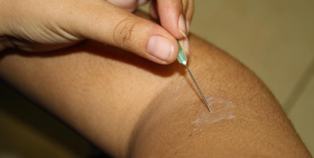 Suman 70 nuevos casos de lepra en 2016