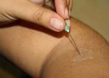 Suman 70 nuevos casos de lepra en 2016