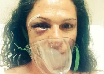 ‘Me golpearon de la manera más cobarde’: Ana Gabriela Guevara