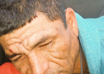 Detenidos por robo refieren haber sido golpeados por policías