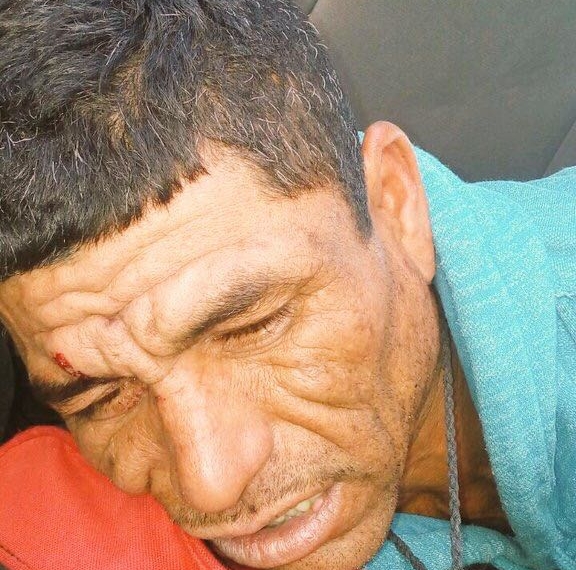 Detenidos por robo refieren haber sido golpeados por policías