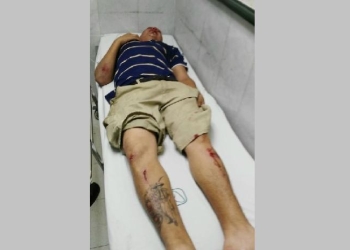 Declara policía que arrolló a ciclista