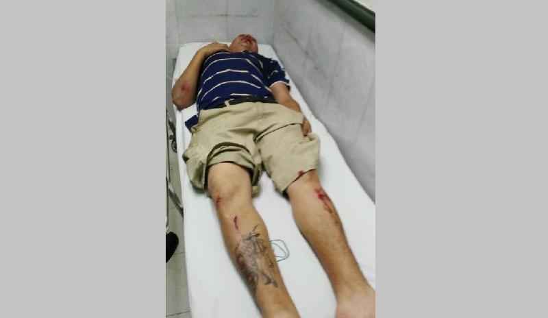 Ciclista arrollado por una patrulla podría quedar paralítico
