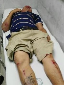 Sigue hospitalizado el ciclista arrollado por una patrulla
