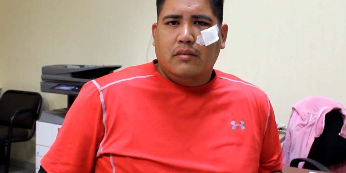 Apedrean un camión y lesionan a pasajero