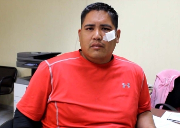 Apedrean un camión y lesionan a pasajero