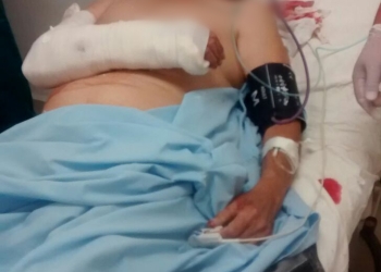 Septuagenario agredido sigue hospitalizado