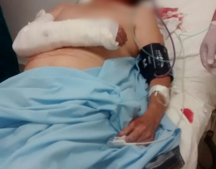 Septuagenario agredido sigue hospitalizado