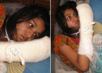 Le cortó los dedos a su esposa… para que dejara de estudiar