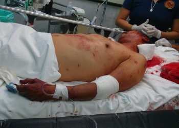 Civiles evitan que taxista fuera asesinado