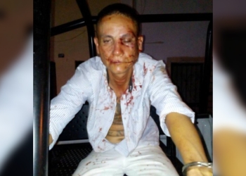 Sujeto resulta lesionado al tratar de robar en un vehículo