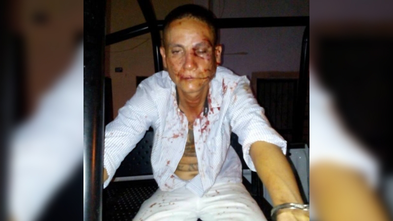 Sujeto resulta lesionado al tratar de robar en un vehículo