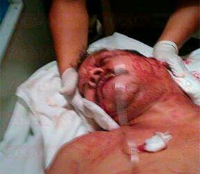 Reportan estable a taxista atacado