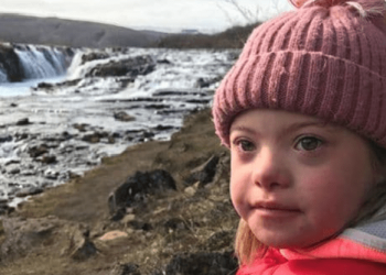 En Islandia el Síndrome de Down está por desaparecer