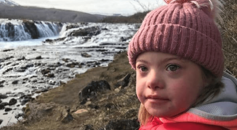 En Islandia el Síndrome de Down está por desaparecer
