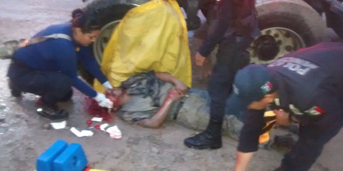 Ciclista arrollado ya está fuera de peligro