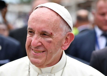 Niño le deja el ojo morado al Papa