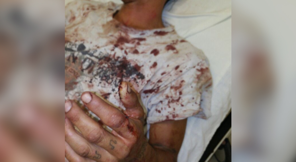 Hombre es herido por su propio hermano