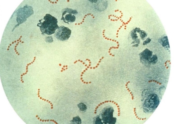 Mata a mexicano bacteria comecarne en Texas