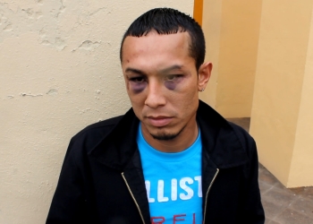 Acusa a policías de golpearlo