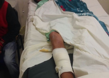 Nadie ha comparecido en caso de menor baleado