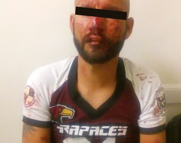 Tras golpiza terminan en el hospital