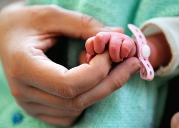Nace muerta una niña con dos cabezas en Guyana
