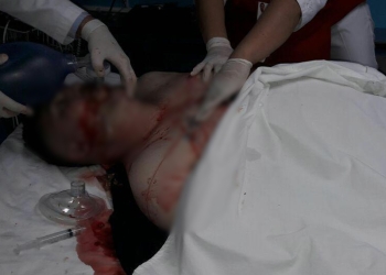 Baleado es reportado grave en hospital