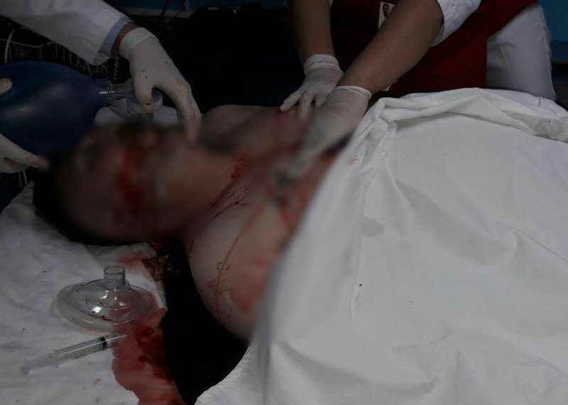 Baleado es reportado grave en hospital