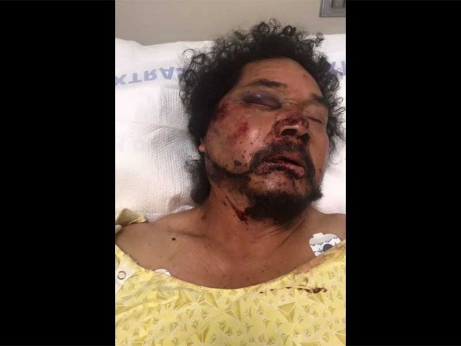 Afroamericanos golpean a mexicano en LA; ciudadanos reúnen 80 mil dólares