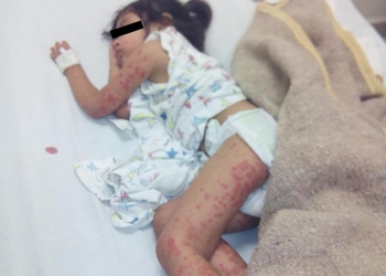 Paola podría ser trasladada hoy al Hospital del Niño en Saltillo