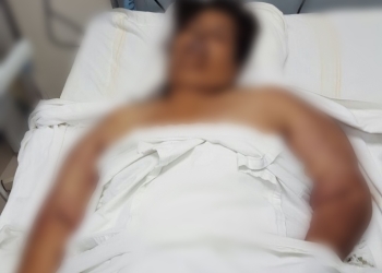 Mujer no murió por intoxicación si no por un infarto