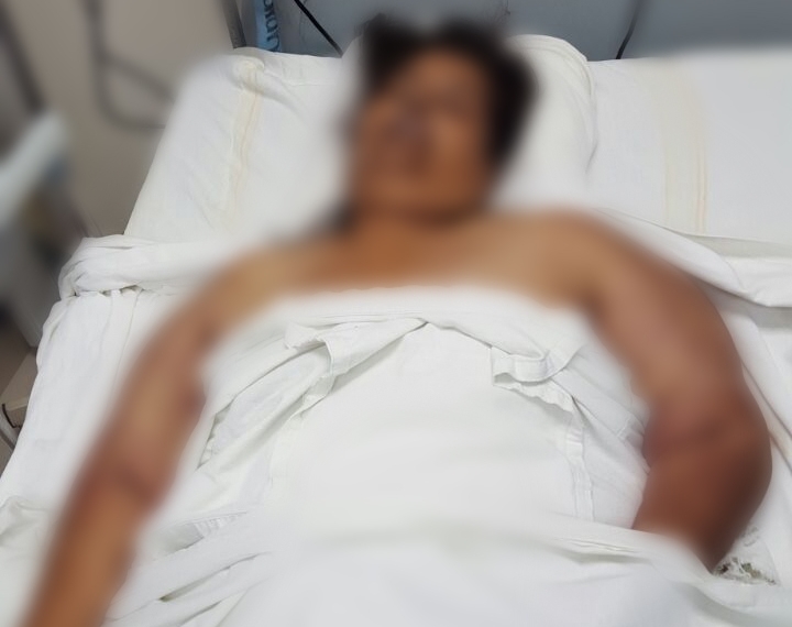 Mujer no murió por intoxicación si no por un infarto