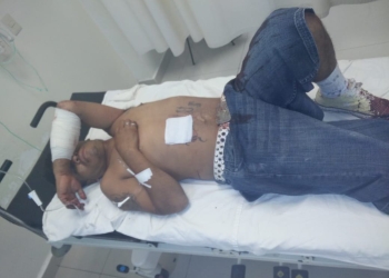 Le otorga el perdón a su hermano