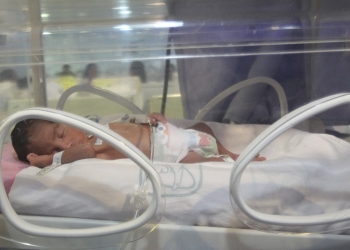 Aumentan nacimientos de bebés prematuros en el IMSS