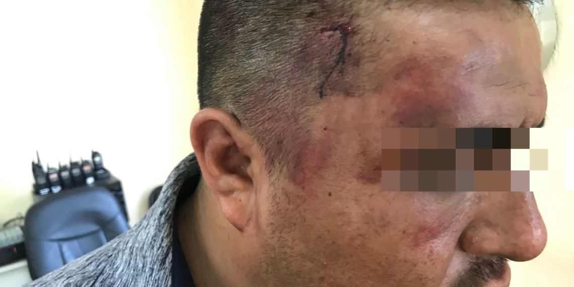 Investigan a policías por tortura