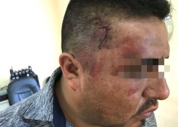 Investigan a policías por tortura