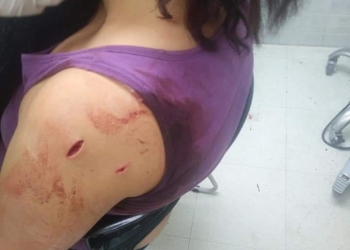 Esposo celoso acuchilla a su mujer