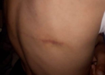 Abuela denuncia a su hija para salvar a sus nietos; el padrastro los golpeaba