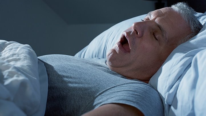 Personas con obesidad son propensas a padecer apnea del sueño: IMSS