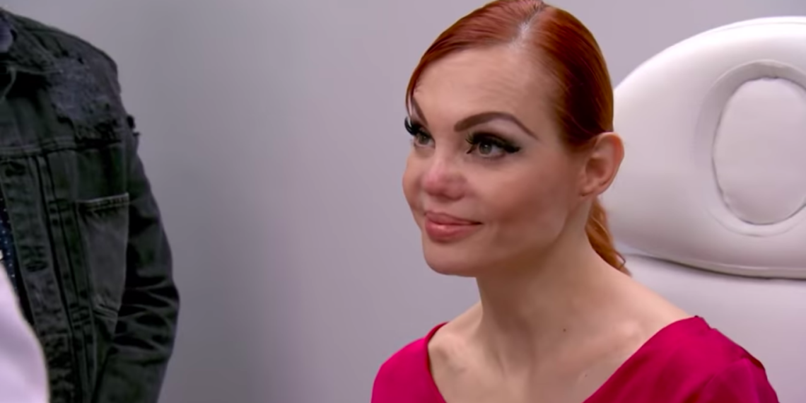Carmen Campuzano aparecerá en un episodio de Botched