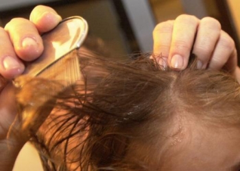 La presencia de piojos y liendres en menores pone en alerta a la Pronnif