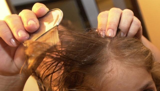 La presencia de piojos y liendres en menores pone en alerta a la Pronnif