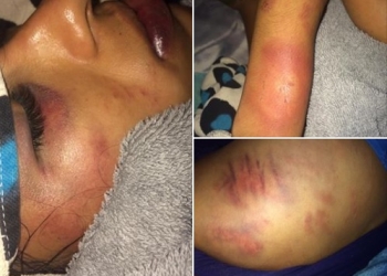 Investigan violación cometida por policías del estado