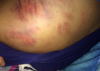 Joven fue violada y torturada por policías de Fuerza Coahuila