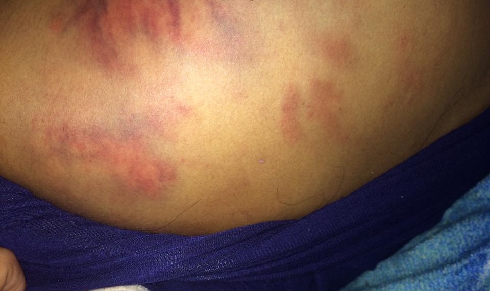 Joven fue violada y torturada por policías de Fuerza Coahuila
